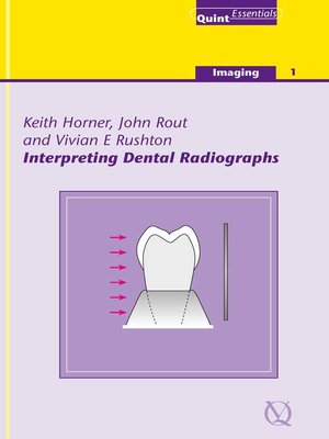 cover image of Interpreting Dental Radiographs